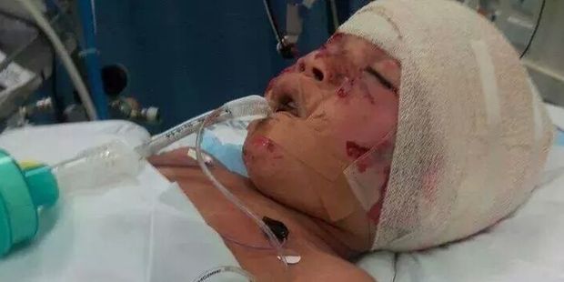 4-year-old Shepherd Mea pictured in intensive care.