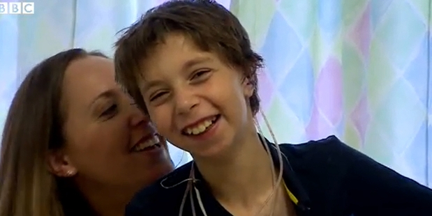 Louise Sorkin, left, provided the model for son Kieran Sorkin's new ears.