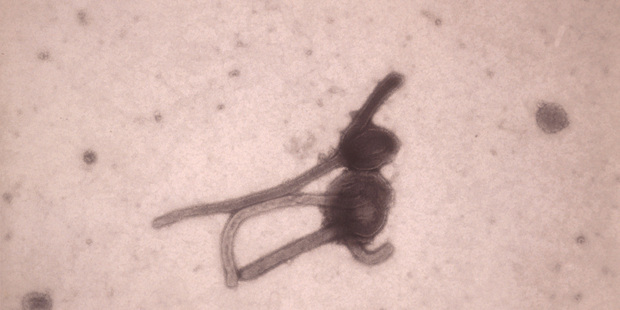 The Ebola virus viewed through an electron microscope. Photo / AP