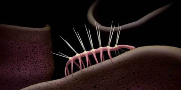 Hallucigenia is a genus of Cambrian animals.
