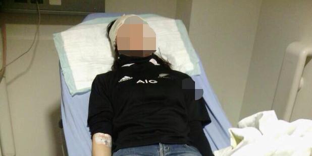 A photo of the fireworks victim posted to the All Blacks' Facebook page.