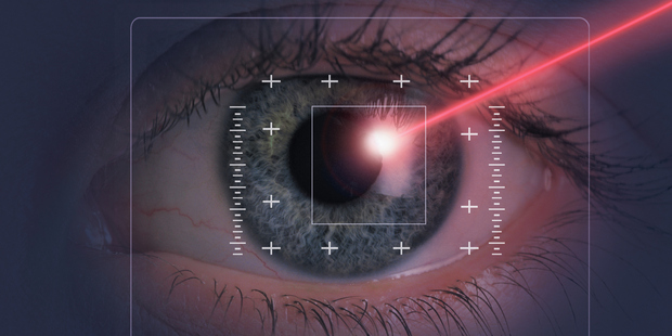 Laser beam on eye