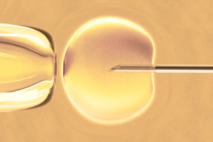 IVF is not a panacea for age-related fertility problems.
Photo / Thinkstock