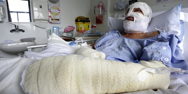 Don Bayliss recovering in hospital after a petrol can exploded in the back of his ute.