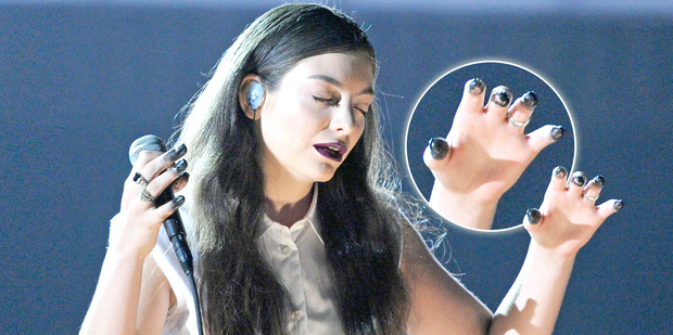 Lorde's black-tinted fingers are under the fashion spotlight. Photo / Getty Images