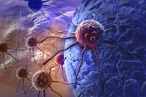 The future global burden of cancer will increasingly shift to poorer countries, WHO said. Image / Thinkstock