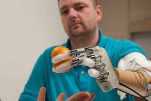 Amputee Dennis Aabo Sorensen holding an orange while wearing sensory feedback enabled prosthesis in Rome. Photo / Science Translational Medicine/AP