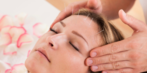 Acupuncture is one of the most popular alternative therapies.
Photo / Thinkstock
