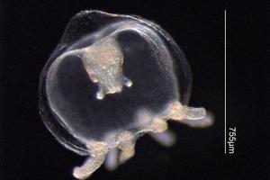The majority of stings from jellyfish at Auckland's beaches during summer are due to microscopic jellyfish known as Hydromedusae.