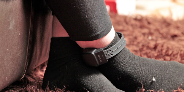 An electronic ankle bracelet monitors offenders on home detention. Photo / NZ Herald