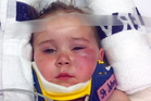 Injured Catherine Alpin, 3, on her way to hospital. Photo/Supplied Injured Catherine Alpin, 3, on her way to hospital. Photo/Supplied