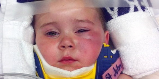 Injured Catherine Alpin, 3, on her way to hospital. Photo/Supplied