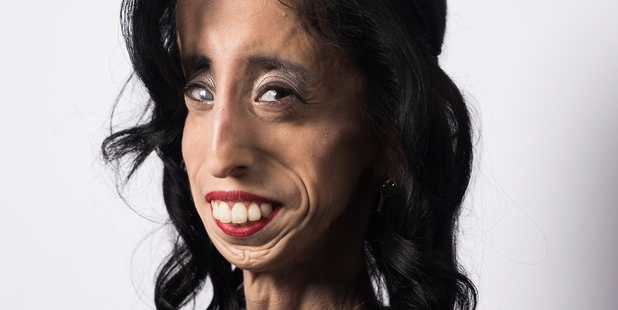 Activist Lizzie Velasquez poses for a portrait for A Brave Heart: The Lizzie Velasquez Story. Photo / Getty Images Portraits