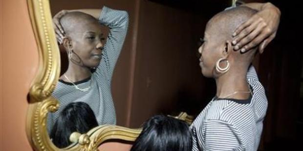 In this Nov. 26, 2014 photo, Marcy Borders shows her shaved head, the result of in her chemotherapy treatment for stomach cancer. Photo: Reena Rose Sibayan/The Jersey Journal via AP