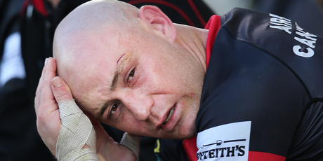 Willi Heinz broke his tibia and fibula last saturday. Photo / Getty Images