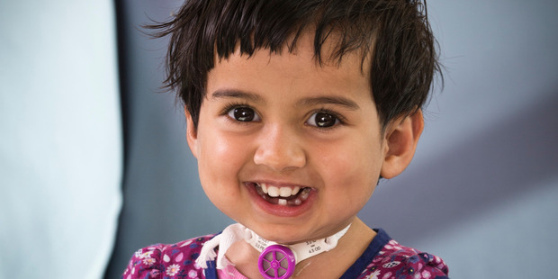 Rare surgery fixes toddler's jaw