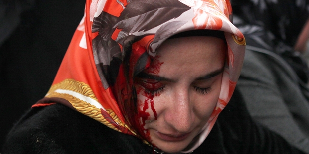 A woman bleeds from an injury after riot police used tear gas and water cannons to disperse people gathered in support, outside the headquarters of Zaman newspaper. Photo / AP