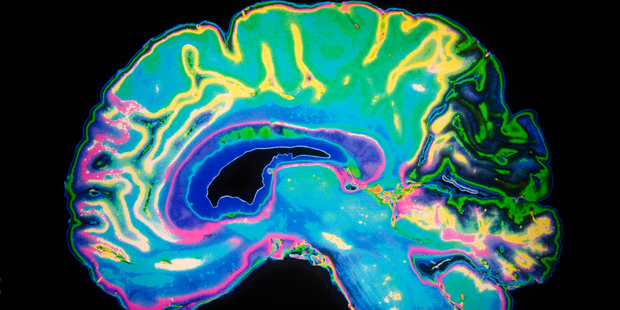 Researchers wanted to find out if bad intentions could be seen forming in the brain before any violence or aggression took place. Photo / Getty Images