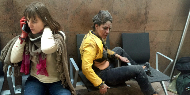 Two women injured in the airport attack. Photo / AP