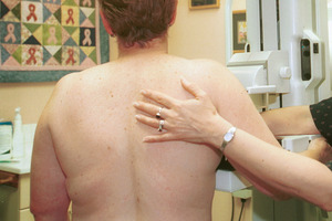 Mammograms may also provide an insight into heart disease in women. Photo / Lynda Forrest