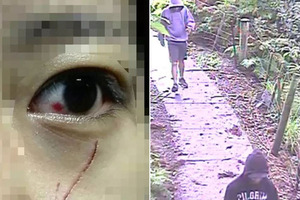 Left, One victim was left with a deep cut under her eye after an attack in Albert Park. Right, CCTV footage shows the offenders in an attack near Unitec in Mt Albert.