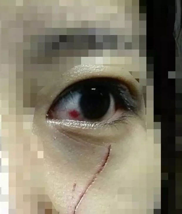 Brutal: A woman was left with a deep cut after she was set upon by a group of six teens.