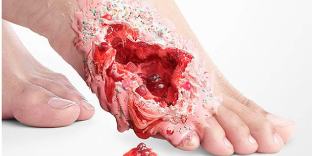 The gruesome shock tactics in advertising are usually reserved for smoking and drink driving, but now the public are being warned of the dangers of the demon sugar. Photo / Supplied