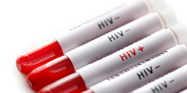 Is a cure for HIV/Aids just years away? Photo / iStock