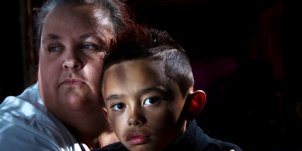 Karla Latu with her son Rawiri Latu, 8, who was attacked by a dog when he was 18 months old. Photo / Stephen Parker