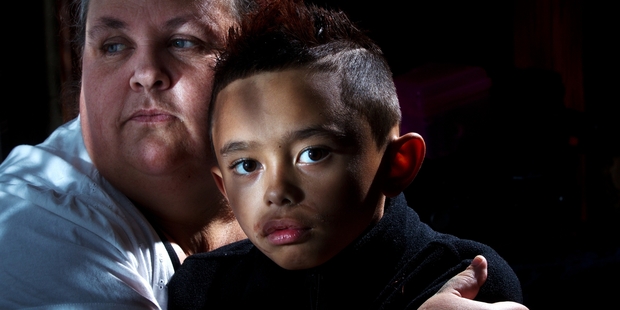 Karla Latu with her son Rawiri Latu, 8, who was attacked by a dog when he was 18 months old. Photo / Stephen Parker
