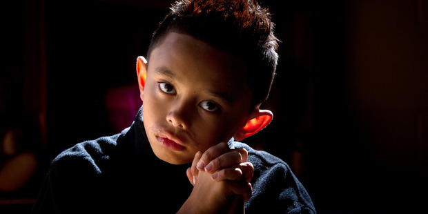 Rawiri Latu, 8, who was attacked by a dog when he was 18 months old. Photo / Stephen Parker
