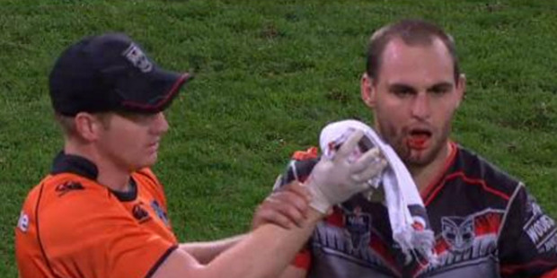 Simon Mannering. Photo / YouTube.