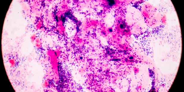Infectious disease experts say New Zealand's strategy to combat antibiotic-resistant bacteria harmful bacteria is "missing in action". Photo / iStock