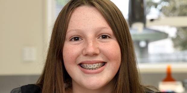 Ella shows off her orthodontic hardware and its result.