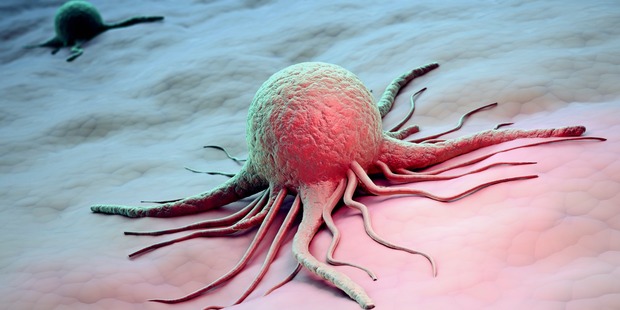 Cancer isn't an inevitable part of aging. Photo / Getty