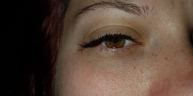 Sarah Tyson of West Auckland received eyelash extensions that went wrong from a salon in West Auckland. Photo / Supplied