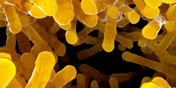 Certain types of bacteria are becoming resistant to antibiotics, causing concern around the world.
