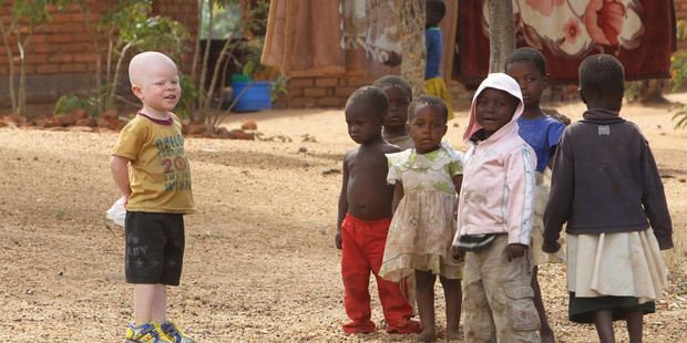 Cassim Jaffalie,3, stands with his friends at their family home in Machinga about 200km north east of Blantyre Malawi. Photo / AP