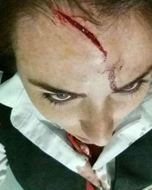 A flight attendant was left with a gash down her forehead. Photo / TrafficAirColom Twitter