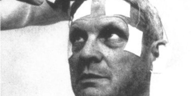 A man allegedly being prepared for testing.