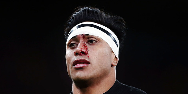 Malakai Fekitoa of New Zealand has his head patched up during the International Test match between the New Zealand All Blacks and Wales. Photo / Getty Images.