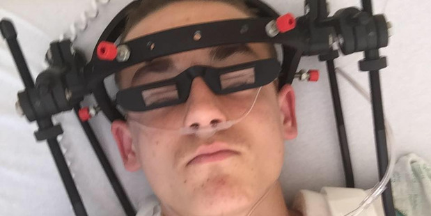 Louis Grindrod with the halo neck brace which was put on his head after his first operation.