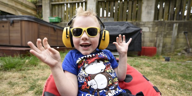 James Reid, 6, is home after the surgery in America. Photo/George Novak