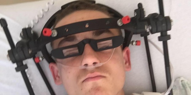 Louis with the halo he had to where for a few days. Photo/Supplied
