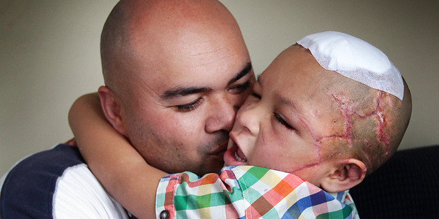 Orlando Shepherd with his son Shepherd Mea who was attacked by their dog in South Auckland on August 2, 2014. Photo / by Doug Sherring