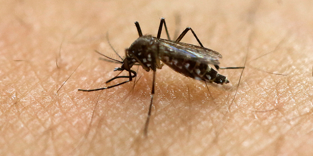 Zika's littlest victims could suffer from microcephaly as well as other birth defects that may not be immediately apparent, including vision defects, hearing problems and seizure disorders. Photo/AP