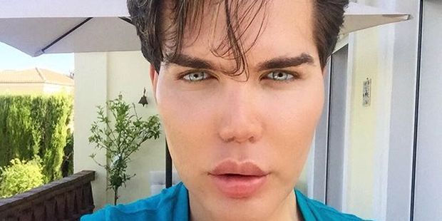 Rodrigo Alves says that he opts for surgery over exercise. Photo / Instagram / rodrigoalvesuk