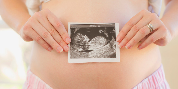 The woman claims that on three occassions her GP and local hospital ignored signs that she was still pregnant. Photo / Getty