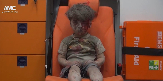 A photo of five-year-old Omran Daqneesh has become the haunting image of the unforgiving struggle. Photo / AP