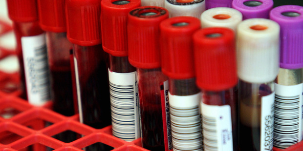 Syphilis symptoms can be hard to detect as they often mimic other disorders. Photo / File